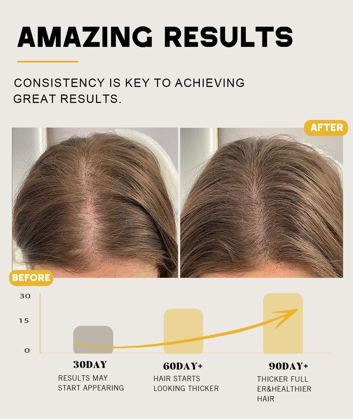 Batana Oil for Hair Growth, 100% Natural Pure Batana Oil Paste from Dr. Sebi Honduras, Prevents Hair Loss, Enhances Thickness, Organic Raw Batana Hair Mask for Women & Men (4.05 Oz)